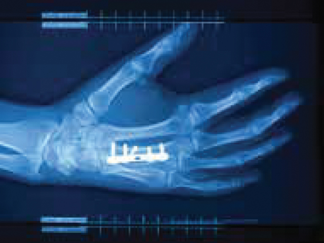 Medical Devices